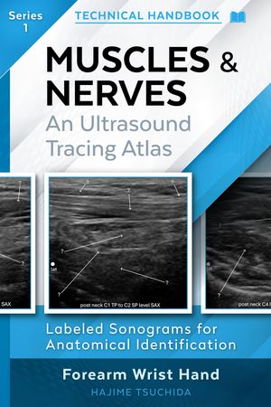 TECHNICAL ULTRASOUND HANDBOOK - MUSCLES & NERVES