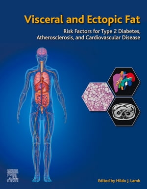 Visceral and Ectopic Fat Risk Factors for Type 2 Diabetes, Atherosclerosis, and Cardiovascular Disease