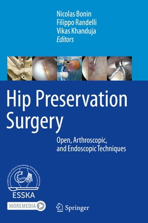 Hip Preservation Surgery Open, Arthroscopic, and