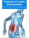 ŷKoboŻҽҥȥ㤨Treatment of Lumbar Disk Herniation Solutions for Relief Pain & Vertebral DecompressionŻҽҡ[ Edgar Ortega M. ]פβǤʤ1,067ߤˤʤޤ