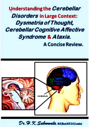 Understanding the Cerebellar Disorders in Large Context: Dysmetria of Thought, Cerebellar Cognitive Affective Syndrome, and Ataxia. A Concise Review.