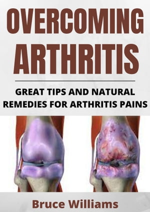 OVERCOMING ARTHRITIS