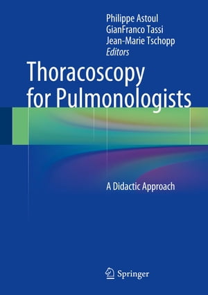 Thoracoscopy for Pulmonologists A Didactic Approach