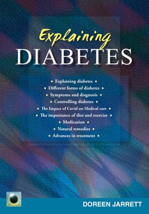 An Emerald Guide to Explaining Diabetes