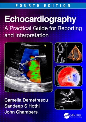 Echocardiography A Practical Guide for Reporting and Interpretation
