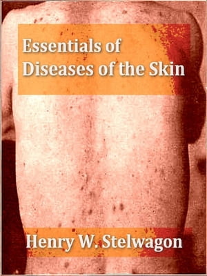 ŷKoboŻҽҥȥ㤨Essentials of Diseases of the Skin, Seventh Edition Including the Syphilodermata, Arranged in the Form of Questions and Answers Prepared Especially for Students of MedicineŻҽҡ[ Henry W. Stelwagon ]פβǤʤ650ߤˤʤޤ