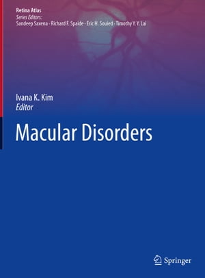 Macular Disorders【電子書籍】