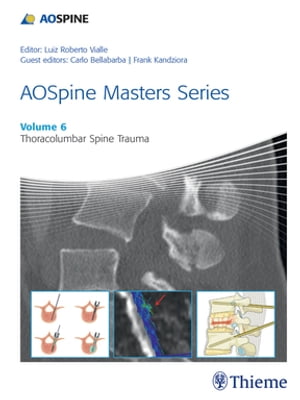 AOSpine Masters Series, Volume 6: Thoracolumbar Spine Trauma【電子書籍】[ Luiz Roberto Gomes Vialle ]