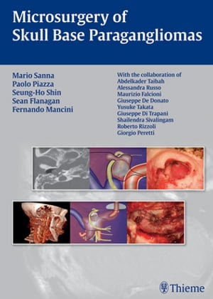 Microsurgery of Skull Base Paragangliomas