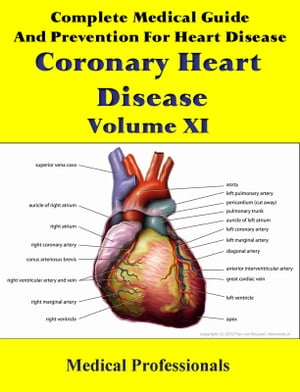 Complete Medical Guide and Prevention for Heart Diseases Volume XI; Coronary Heart Disease