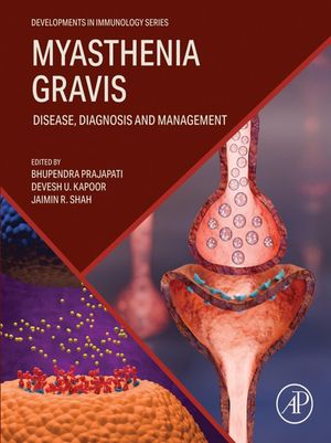 Myasthenia Gravis Disease, Diagnosis and Managem