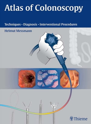 Atlas of Colonoscopy Techniques - Diagnosis - Interventional ProceduresŻҽҡ[ Helmut Messmann ]