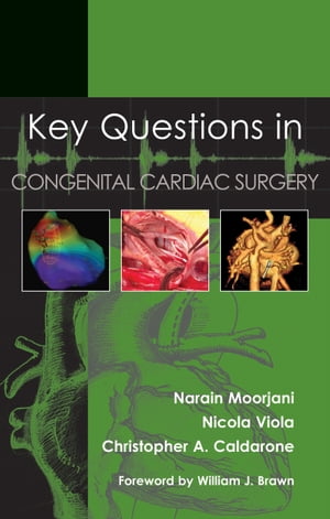 Key Questions in Congenital Cardiac Surgery【電子書籍】 Narain Moorjani