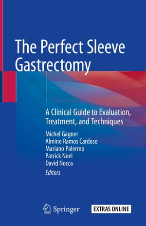 The Perfect Sleeve Gastrectomy