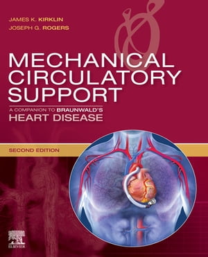 Mechanical Circulatory Support