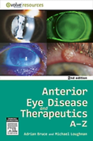 Anterior Eye Disease and Therapeutics A-Z - E-Book