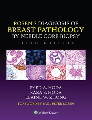 Rosen 039 s Diagnosis of Breast Pathology by Needle Core Biopsy【電子書籍】 Syed A. Hoda