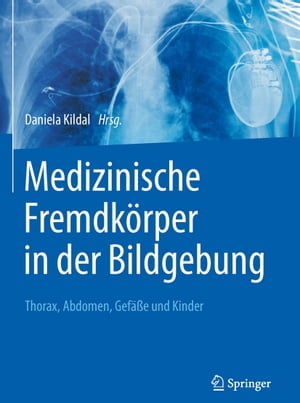 Medizinische Fremdk?rper in der Bildgebung Thorax, Abdomen, Gef??e und KinderŻҽҡ