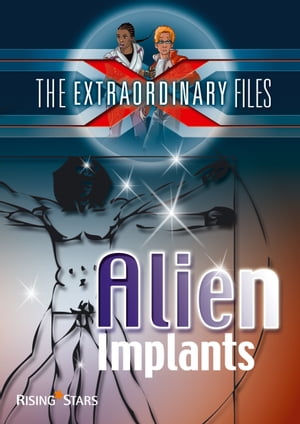 ŷKoboŻҽҥȥ㤨Alien ImplantsŻҽҡ[ Paul Blum ]פβǤʤ746ߤˤʤޤ