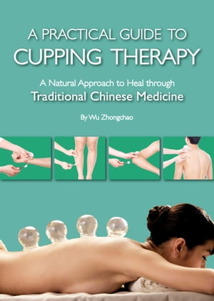 Practical Guide to Cupping Therapy A Natural Approach to Heal Through Traditional Chinese Medicine【電子書籍】 Zhongchao Wu