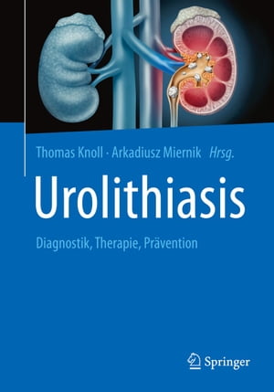 Urolithiasis Diagnostik, Therapie, Pr?vention【電子書籍】