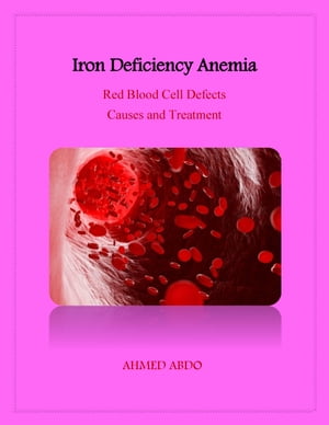 Iron Deficiency Anemia【電子書籍】[ AHMED 