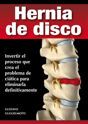 Hernia de disco - cerrar sin cirugía