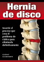 ŷKoboŻҽҥȥ㤨Hernia de disco - cerrar sin cirug?aŻҽҡ[ Gustavo Guglielmotti ]פβǤʤ1,212ߤˤʤޤ