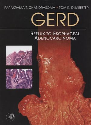 ŷKoboŻҽҥȥ㤨GERD Reflux to Esophageal AdenocarcinomaŻҽҡ[ Tom R. DeMeester ]פβǤʤ11,600ߤˤʤޤ