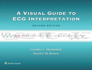 A Visual Guide to ECG Interpretation