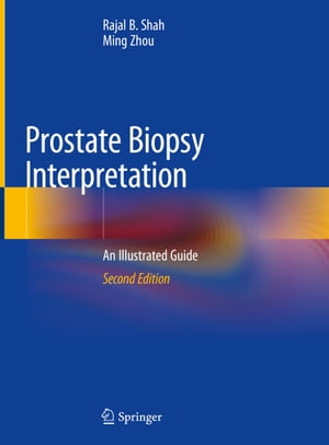 Prostate Biopsy Interpretation