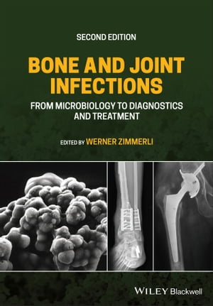 Bone and Joint Infections From Microbiology to Diagnostics and Treatment