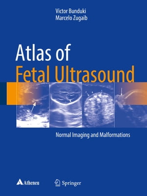 Atlas of Fetal Ultrasound Normal Imaging and Malformations【電子書籍】[ Victor Bunduki ]