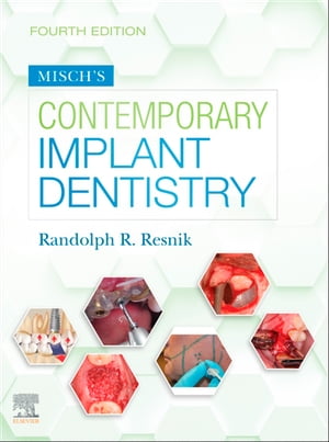 Misch's Contemporary Implant Dentistry E-Book