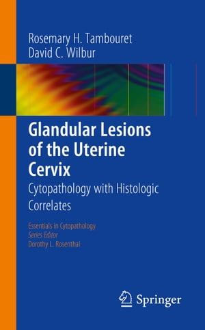 Glandular Lesions of the Uterine Cervix