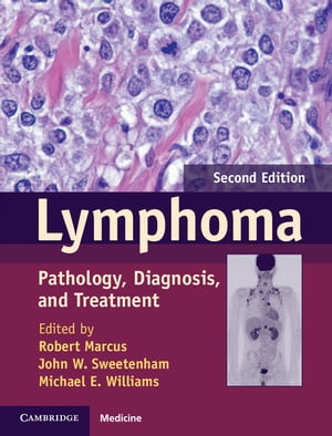 Lymphoma Pathology, Diagnosis, and Treatment【電子書籍】