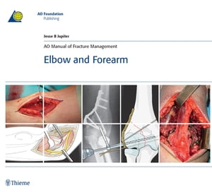 楽天楽天Kobo電子書籍ストアAO Manual of Fracture Management - Elbow and Forearm【電子書籍】[ Jesse Jupiter ]