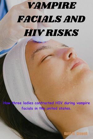 Vampire facials and HIV risks