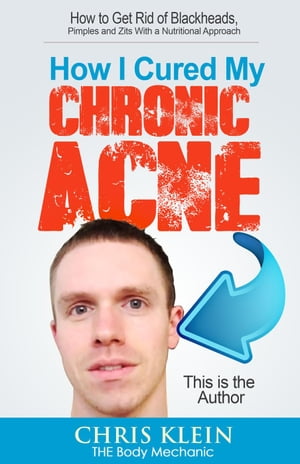 ŷKoboŻҽҥȥ㤨How I Cured My Chronic Acne: How to Get Rid of Blackheads, Pimples and Zits With a Nutritional ApproachŻҽҡ[ Chris Klein ]פβǤʤ120ߤˤʤޤ