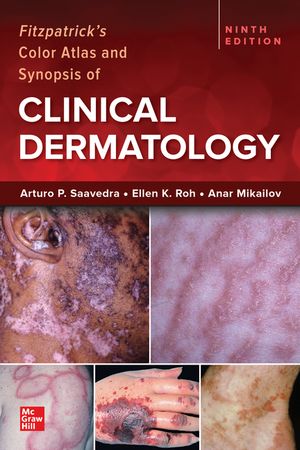 Fitzpatrick's Color Atlas and Synopsis of Clinical Dermatology, 9/e