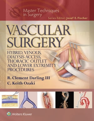 Master Techniques in Surgery: Vascular Surgery: Hybrid, Venous, Dialysis Access, Thoracic Outlet, and Lower Extremity Procedures