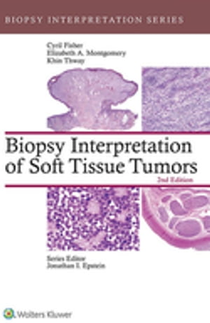 Biopsy Interpretation of Soft Tissue Tumors