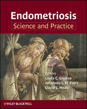 Endometriosis Science and Practice【電子書籍】