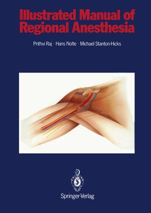 Illustrated Manual of Regional Anesthesia