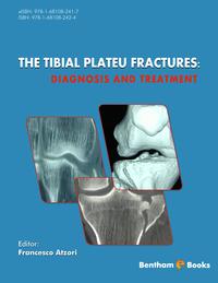 The Tibial Plateu Fractures: Diagnosis and Treatment Volume: 1