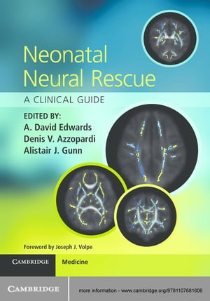 Neonatal Neural Rescue