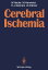 Cerebral Ischemia