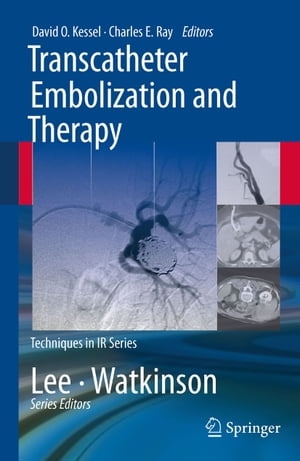 Transcatheter Embolization and Therapy【電子書籍】