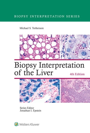 Biopsy Interpretation of the Liver【電子書籍】[ Michael Torbenson ]