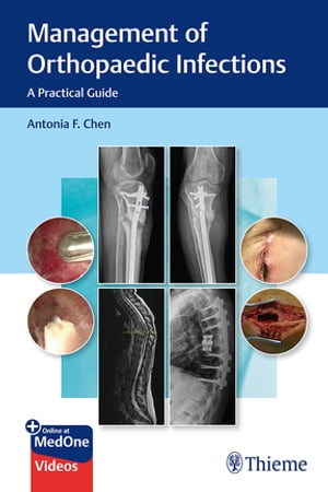 Management of Orthopaedic Infections A Practical Guide